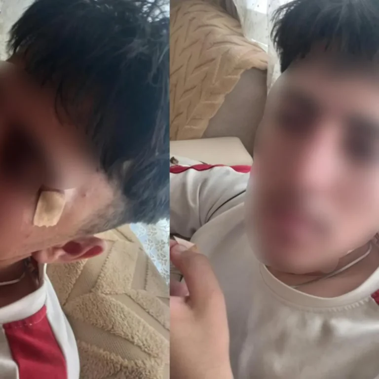 Afyonkarahisar'da öğretmenin kafa attığı 16 yaşındaki çırak hastanelik oldu!